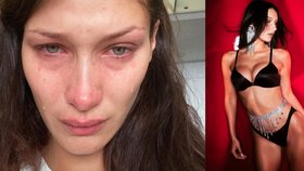 Modelka Bella Hadidová (25): Přiznala potíže s chlastem!