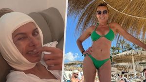 Bendová (52) po děsivém videu: Popsala detaily zákroku! Bendová (52) po děsivém videu: Popsala detaily zákroku!