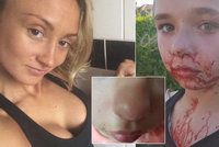 Boxerka (28) zmlátila školačku (11). Dívka skončila se zlomeným nosem a celá od krve