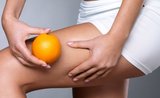 Cvičte proti celulitidě: 6 cviků, kterými porazíte pomerančovou kůži