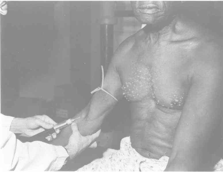 Černoši byli zahrnuti do tajného programu ministerstva zdravotnictví, který měl zkoumat, jaký dopad má na lidské tělo syfilis. Pokud se nijak neléčí.