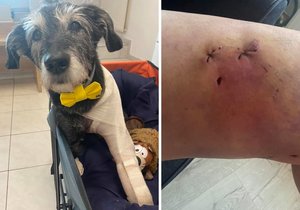After the pit bull attack, Drea ended up and her dog was injured.