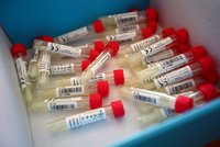 Jeden test má rozpoznat koronavirus i chřipku: Rektor Zima slibuje výsledky do hodiny