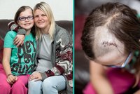 V mozku jí bujela rakovina: Pozorný optik holčičce (10) zachránil zrak i život
