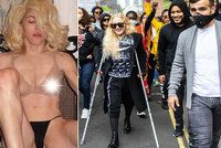 Navždy mladá Madonna (61)? Na protesty v Londýně se belhala o berlích!