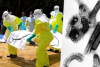 Krvácení, zvracení a smrt 8 lidí z 10: Nebezpečný virus Marburg se objevil na novém místě