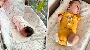 Maxík se narodil bez končetin: Žaloba na lékaře! Matka ukázala dokumenty z ultrazvuku Maxík se narodil bez končetin: Žaloba na lékaře! Matka ukázala dokumenty z ultrazvuku