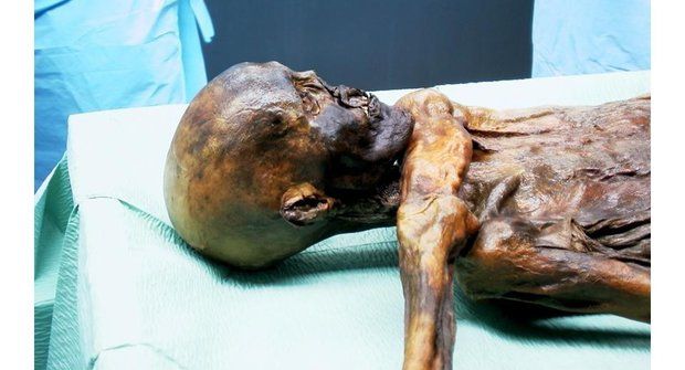 Nemocné mumie: Dávné stopy moderních neduhů