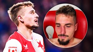 Na hranici sebeobětování. Sadílek si po Lens odnesl zlomený nos: jako MMA fighter! Na hranici sebeobětování. Sadílek si po Lens odnesl zlomený nos: jako MMA fighter!