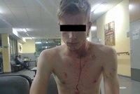 Podlý útok na šestnáctiletého chlapce: Zezadu ho bodli do hlavy