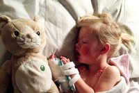 Děvčátko málem zabil Nurofen: Následky si ponese celý život