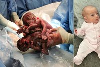 Dvojčátka se narodila o deset týdnů dřív: Poté, co je vyňali z dělohy, se sestřičky objímaly!