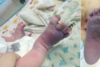 Domácí porod skončil neštěstím: Dula zlámala miminku nohy