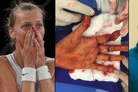 Útok na Kvitovou: Žondra tenistku napadl a pořezal jí ruku, dostal osm let!