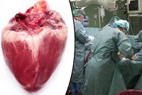 Muž, kterému jako prvnímu transplantovali umělé srdce: Po 75 dnech zemřel!