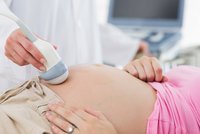 Každé desáté těhotenství končí umělým vyvoláváním porodu. Lékařka: Zbytečně