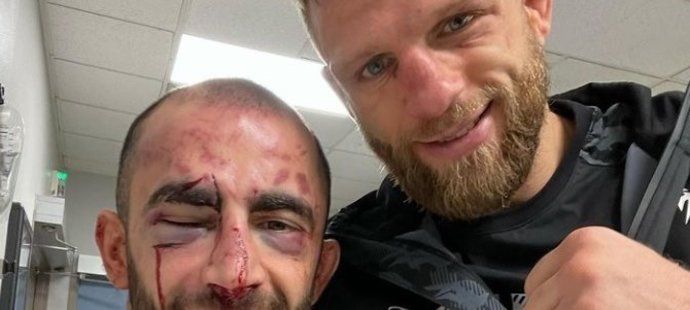 Calvin Kattar se s Gigem Čikadzem potkali po zápase v nemocnici