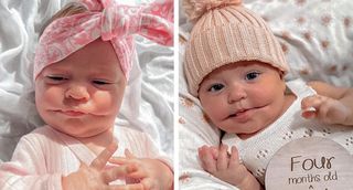 Vada na kráse, nebo roztomilost? Tato holčička se narodila se vzácnou poruchou: permanentním úsměvem! 