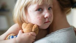 Velký přehled nemocí s vyrážkou u dětí: Jak poznat neštovice, ekzémy i meningitidu