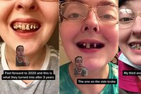 Mámě shnily horní zuby poté, co pila 10 let limonády s bublinkami