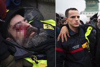 Červené šátky, žluté vesty a policejní děla: Vůdce protestů trefili v Paříži do oka
